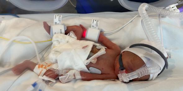 Baby Teddy in an incubator