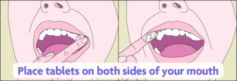 Diagram showing tablets being placed between the cheek and gum at both sides of the mouth