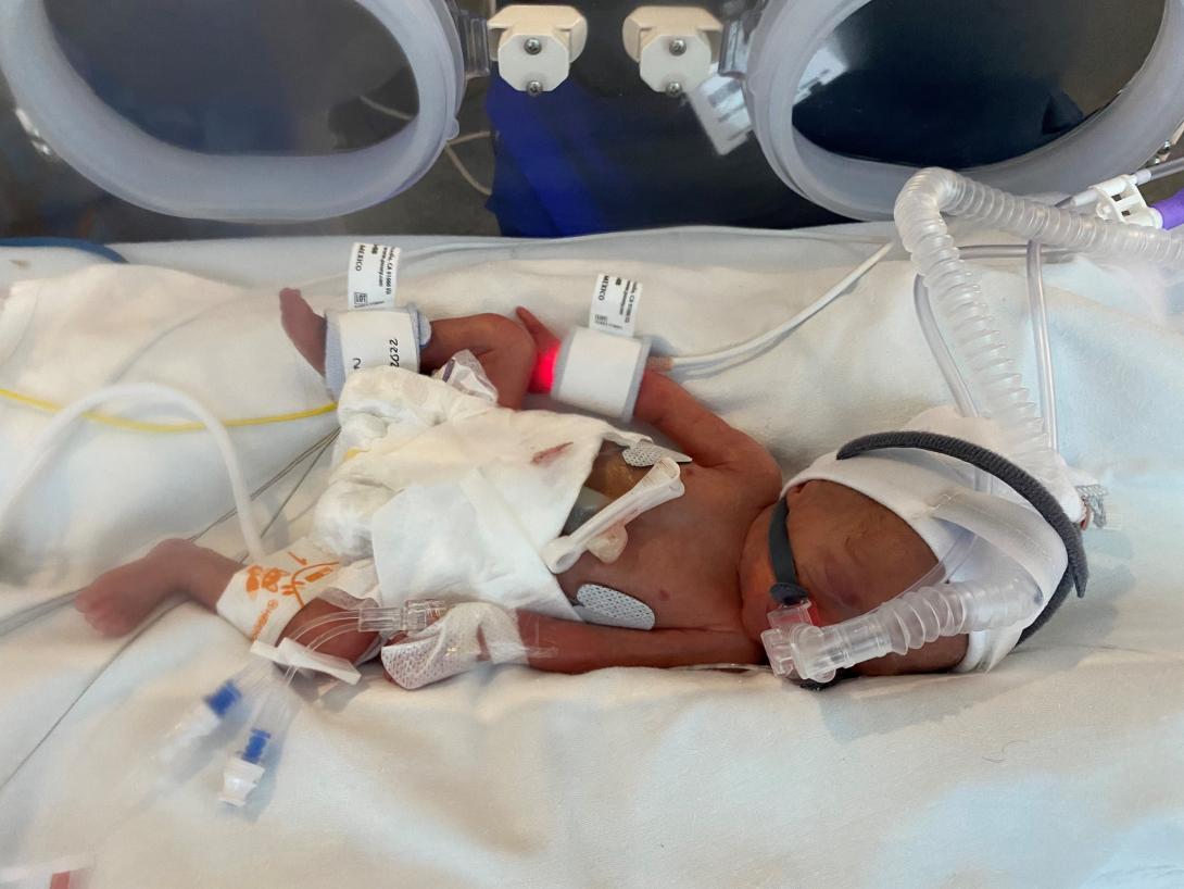 Baby Teddy in an incubator